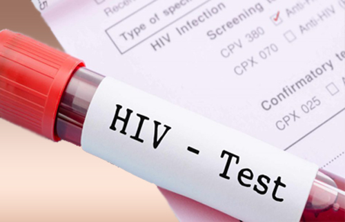 Does Medicare cover HIV treatment