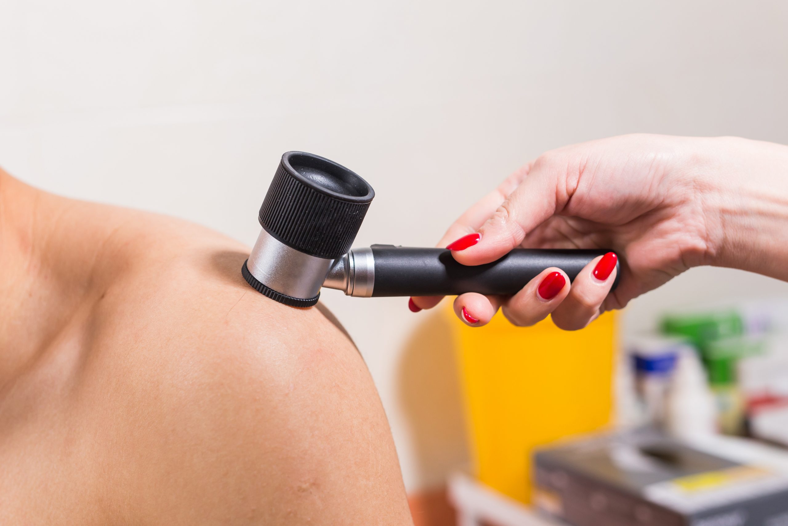 medicare melanoma screening