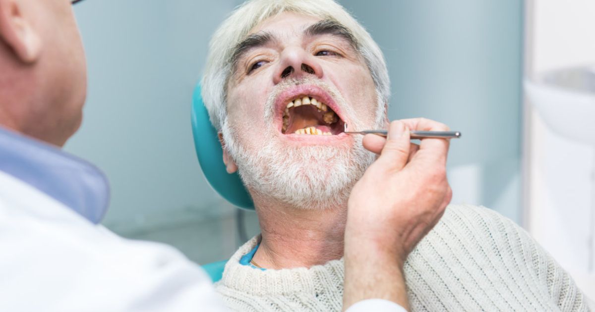 Medicare oral surgery