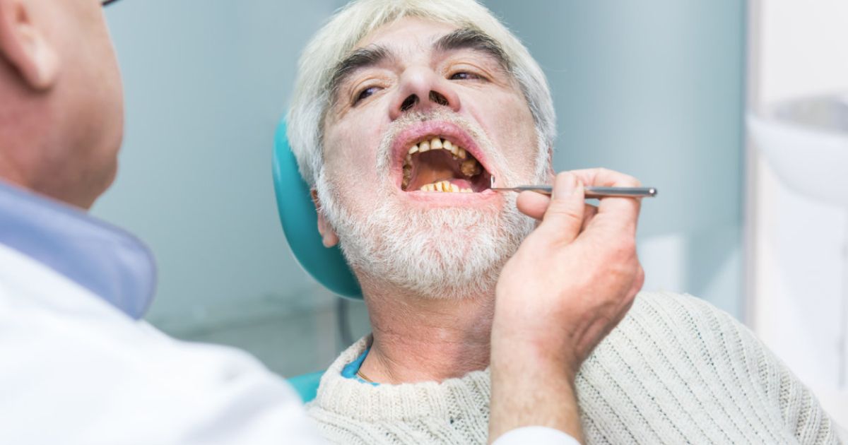 medicare oral surgery