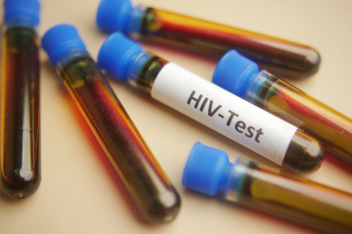 hiv/aids symptoms in males - Get a Quote and Discover Your Medicare Plan Options hiv/aids symptoms in males