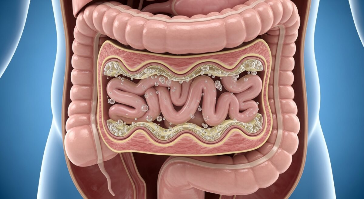 bowel cancer stomach noises